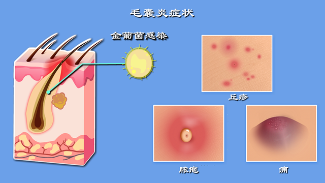 女性私处毛发可以剃掉？私处毛发的这3种用处，你需要了解